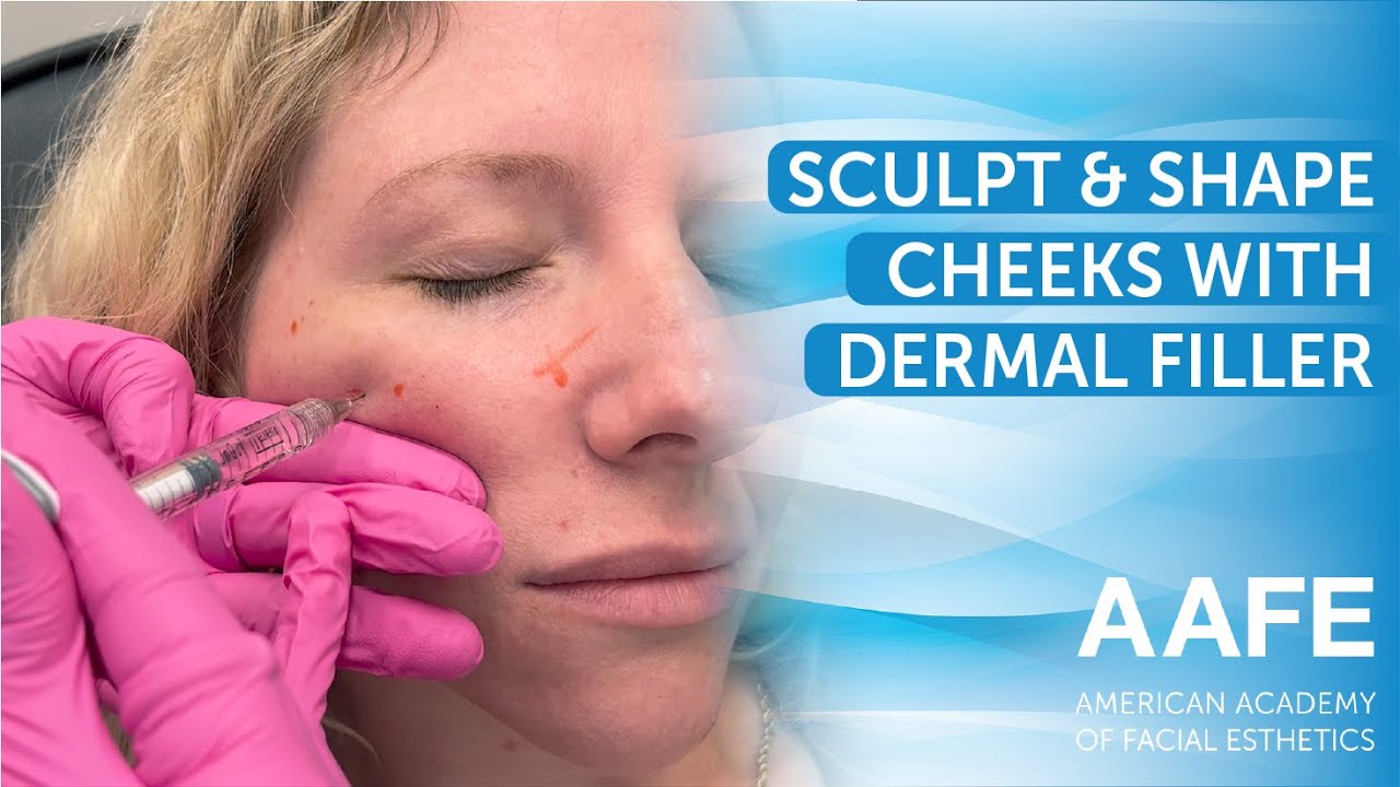 Sculpt and Shape Cheeks with Dermal Filler - YouTube