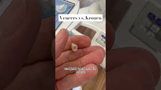 Unterschied Veneers Vs. Kronen Önezähne