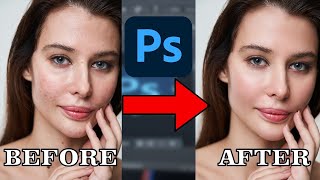 Photoshop Tutorials | How to fix acne perfectly | Face Retouching with Texture | @Photoshop 