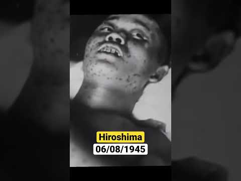 Horror Hiroshima Bombing u0026 Victims ? #shorts