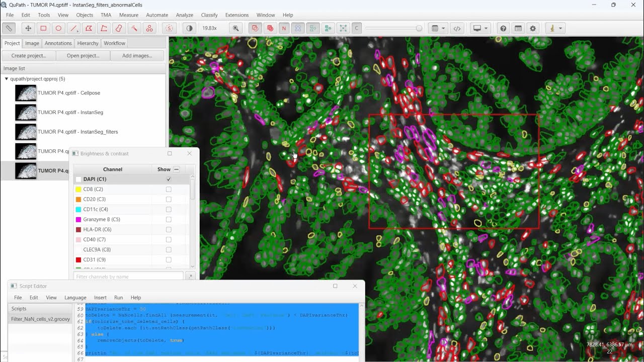 Instanseg Practical Considerations for Using InstanSeg v Cellpose in QuPath for ...