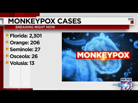 Monkeypox case connected with Wedgefield School, district says