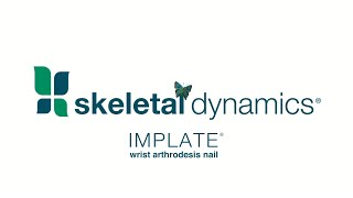 IMPLATE® Wrist Arthrodesis Nail from Skeletal Dynamics
