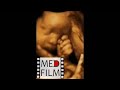 (Sh) 3D Ultrasound. 31 weeks pregnant. The kid scratches his nose © 3D УЗИ, 31 неделя беременности