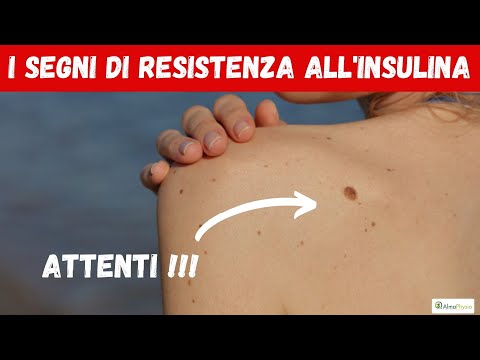 Video: 3 modi per ridurre la resistenza all'insulina