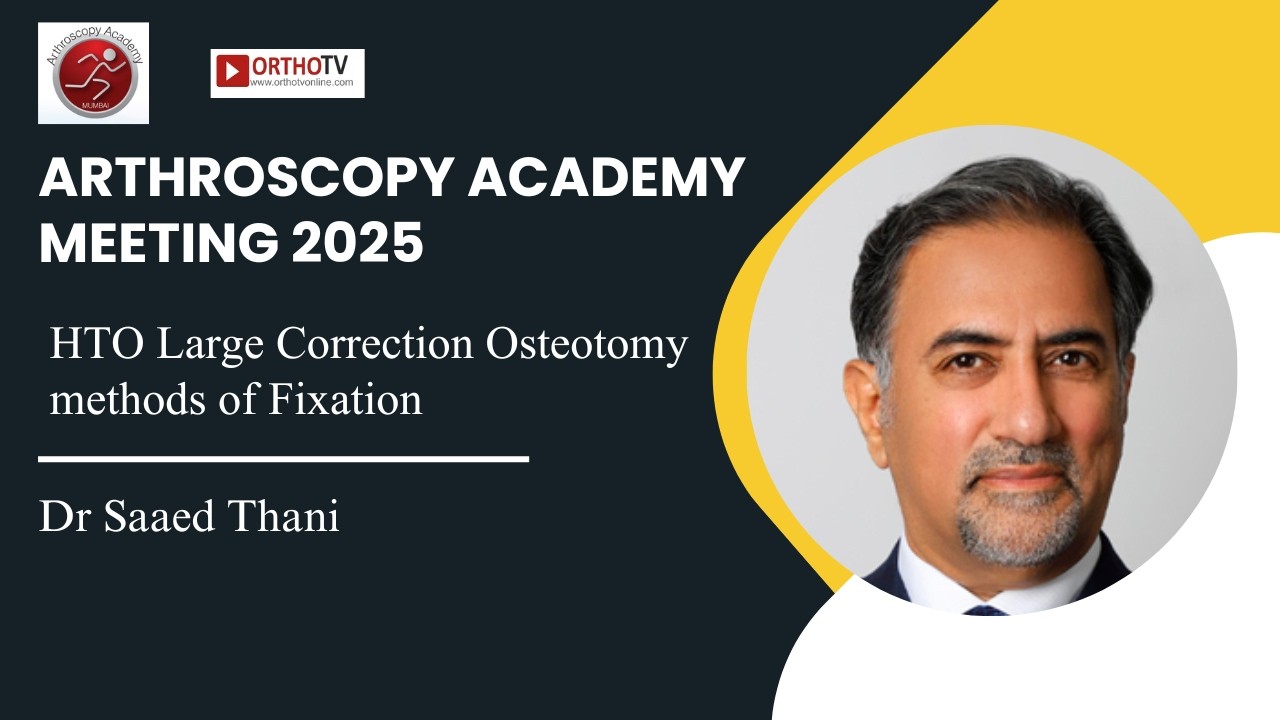 ARTHROSCOPY ACADEMY MEETING 2025 :HTO Large Correction Osteotomy methods of Fixation -Dr Saaed Thani