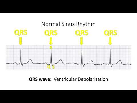Single ECG Lead Analysis