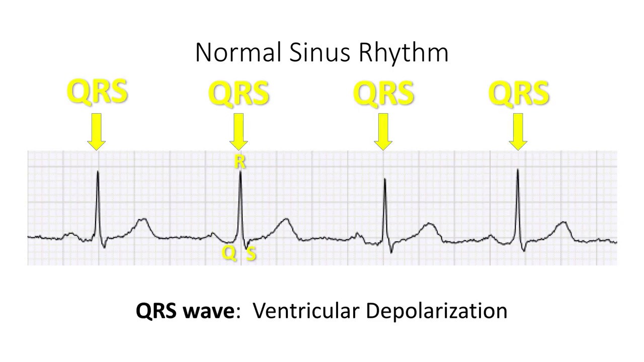 Single ECG Lead Analysis
