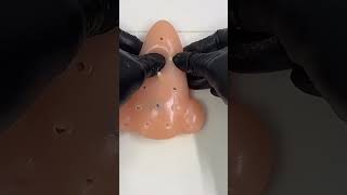 Impressive blackhead removal #asmr #viral #shorts #fypシ