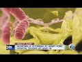 Salmonella patients at Henry Ford Hospital