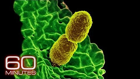 Cases of antibiotic resistant bacteria In U.S. neonatal intensive care units increasing