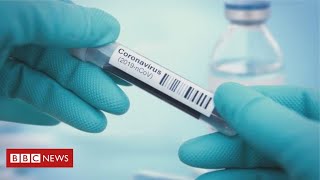 Coronavirus: medical staff struggle to get tested as govt says it’s passed 100,000 target - BBC News