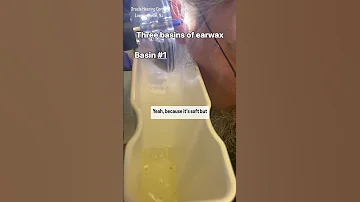 THREE Basins Of Earwax 