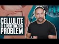 Cellulite is a Dehydration Problem! | What the Fitness | Biolayne