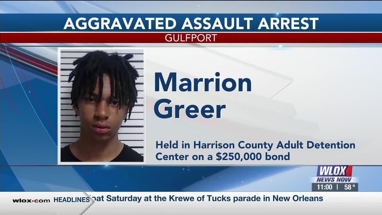 Gulfport teen charged after shooting injures 14-year-old in fight over ...