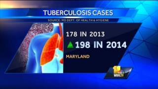 TB investigation expanding in Catonsville