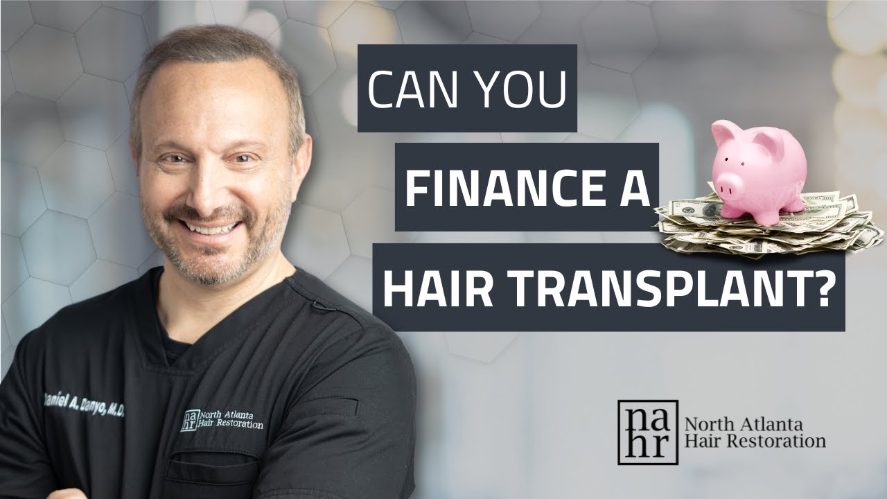 Can You Finance a Hair Transplant?