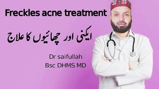 Freckle Causes Signs and Symptoms Diagnosis and Treatment