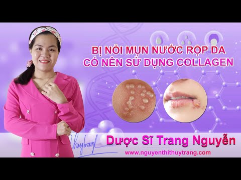 Bị mụn nước rộp da có nên sử dụng collagen viên uống