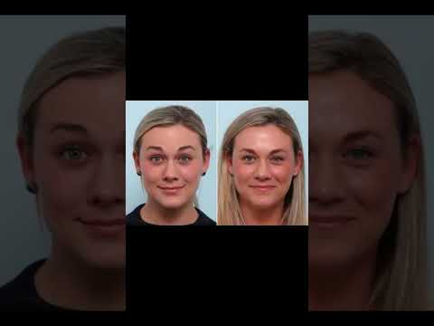 Elasty Unlock Your Skin S Natural Glow BeautyBlogger SkinBoosters GlowingSkinTi YouthfulSkin