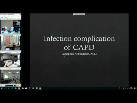 Infection Complication of CAPD