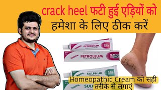 Crack Heel फटी हुई एड़ियां को हमेशा के लिए ठीक करें | heal cracked heels | Homeopathic Medicine |
