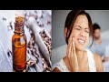 How to use clove and clove oil for tooth pain relief |