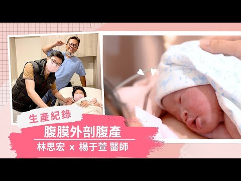 超爆笑生產紀錄！林思宏醫師給二寶媽的調皮驚喜～讓媽咪怒嗆還要回來生！｜腹膜外剖腹產｜禾馨醫療