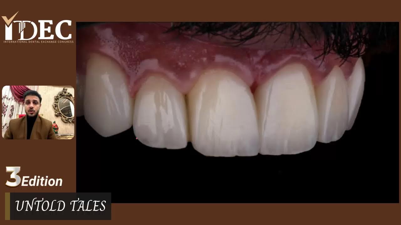 صاحب اقوي محاضرة في ال IDEC 2024  ونجم الجمهور #دكتور_كريم_معوض