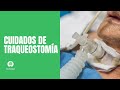 Cuidados de traqueostomía en paciente COVID-19 al egreso hospitalario