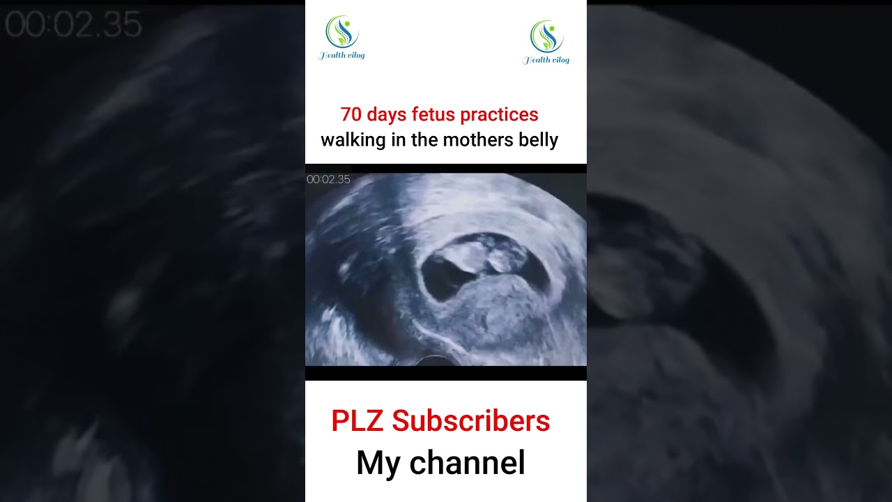 70 days fetus practices walking in the mothers belly 