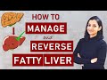 Tips to MANAGE and REVERSE FATTY LIVER DISEASE |  Non-alcoholic Fatty Liver Disease (NAFLD)
