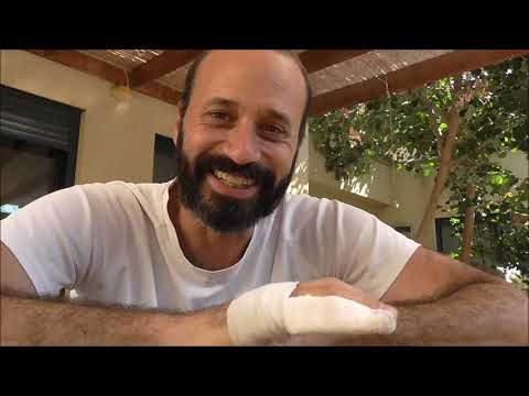 שברתי אצבע - הזדמנות לדבר על קיבועים