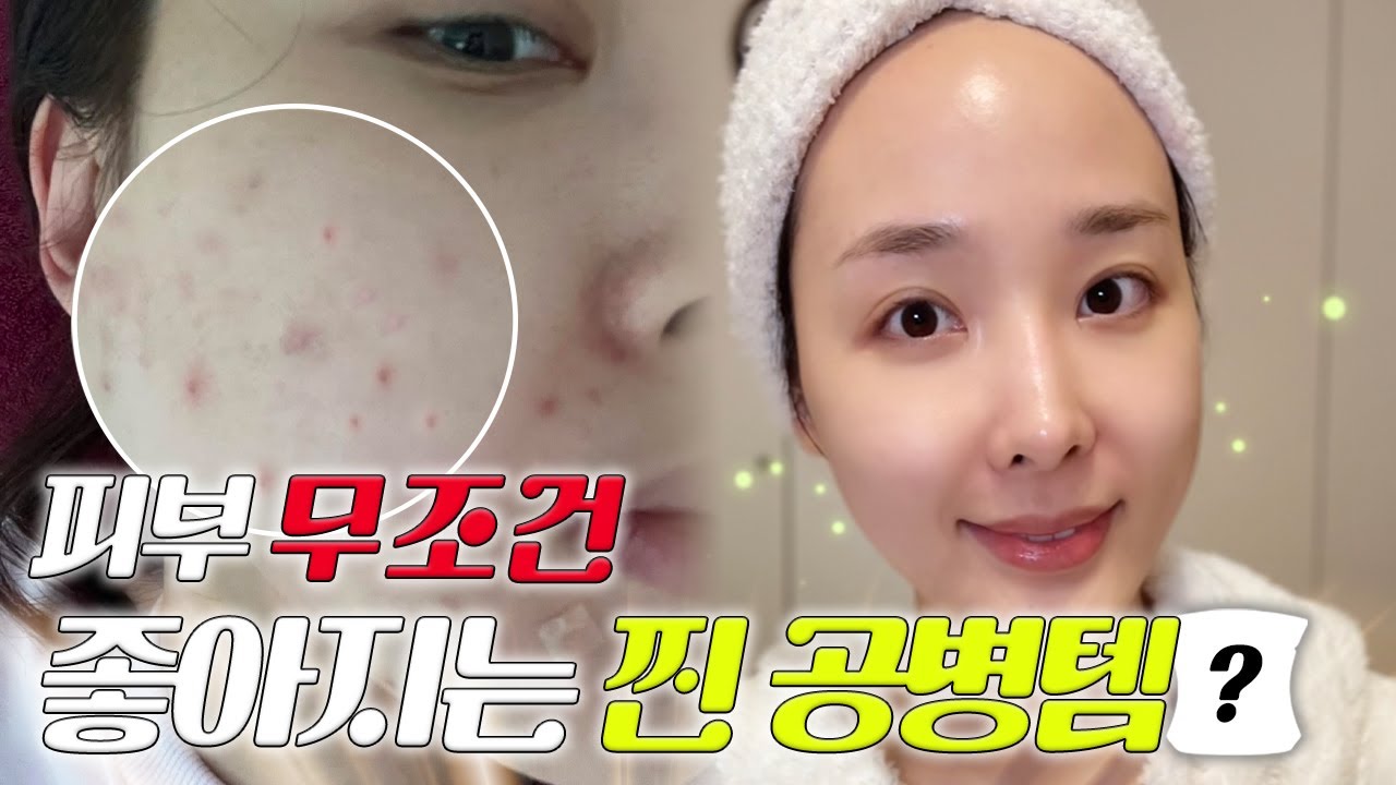 여드름녀에서 꿀피부 뷰티쇼호스트로 바꿔준 찐 공병템 🧴알려지지 않은 피부 좋아지는 찐템들 탈탈 털어서 보여드려요 👑