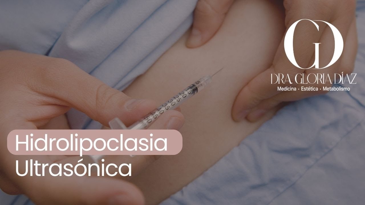 Todo sobre la hidrolipoclasia ultrasónica: moldeá tu cuerpo sin cirugía
