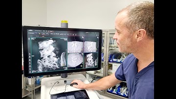 3D Imaging for Interventional Spine & Orthopedics + Dynamic Motion Imaging - Siemens Ciartic Move