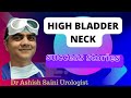 High bladder neck success stories