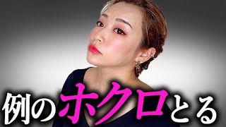 ついにあのホクロを取ることにしました