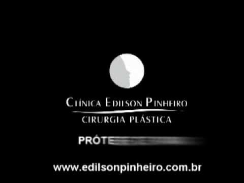 Entenda como Ã© o processo cirÃºrgico da PrÃ³tese de Mama (Silicone), atravÃ©s de vÃ­deos explicativos em 3 dimensÃµes. VÃ­deo elaborado pela ClÃ­nica Edilson Pinheiro de Cirurgia PlÃ¡stica, em Fortaleza, CearÃ¡, Brasil. Acesse: www.edilsonpinheiro.com.br para mais informaÃ§Ãµes sobre tÃ©cnicas, indicaÃ§Ãµes, resultados, perÃ­odo de internaÃ§Ã£o, cicatrizaÃ§Ã£o e demais dÃºvidas.