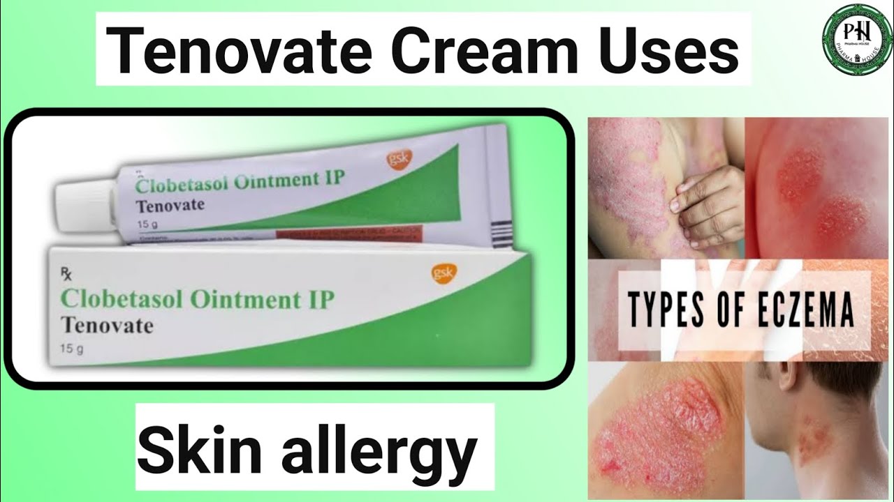 Tenovate Cream Uses In Hindi Clobetasol Uses Eczema Treatment Skin tenovate-cream-uses-in-hindi-clobetasol-uses-eczema-treatment-skin