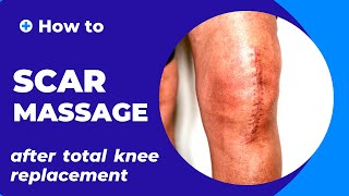 Scar Massage after Total Knee Replacement (TKR).