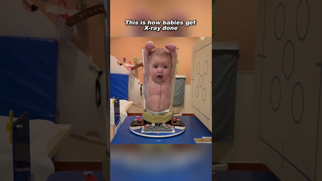 How a baby gets a x-ray