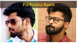 How to Grow Beard faster | Fix patchy Beard | Tamil | Shadhikazeez