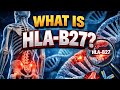 HLA-B27 - What is it? The gene behind some arthritis conditions. #arthritis #ankylosingspondylitis
