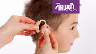 صباح العربية | السماعات العظمية الالكترونية أمل لفاقدي السمع