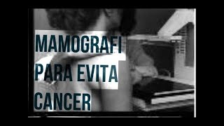 MAMOGRAFIA ESTUDIO PARA PREVENIR EL CANCER Y ERRADICARLO A TIEMPO