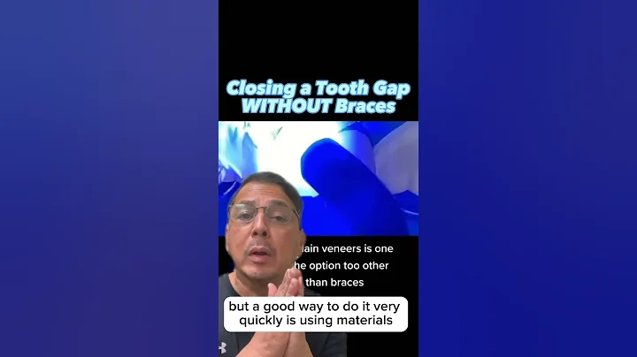A QUICK Way Dentists Can Close a Front Tooth Gap | View Mobile Dental #shorts