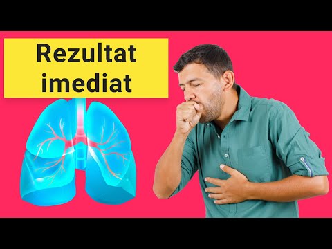 Cum scapi rapid de mucus si flegma?