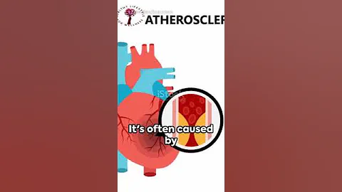 Cardio Metabolic Syndrome: The Link Between Heart Disease, Diabetes, and Hypertension  Explained