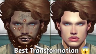 Get Ready To Glow Acne Removal And Facial Makeup With An Asmr Animation Treatment